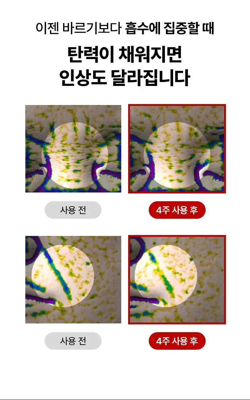 [1등 총알샷 탄력 패치]니들리 5존 링클케어 3600샷 패치 상세페이지 7